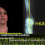 chirurgie orthopédique, chafiaa hamitouche